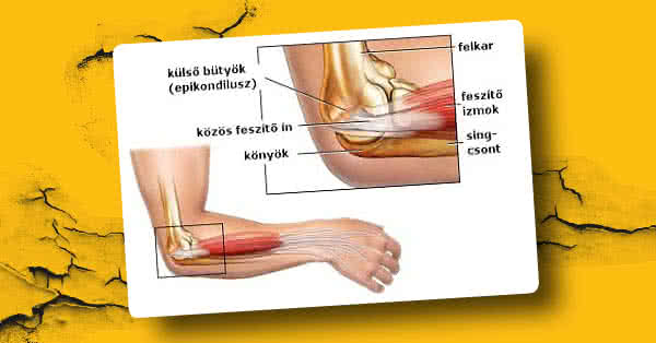 fájdalom kezelése a nagy lábujj ízületében ízületi váll sérülések kezelése