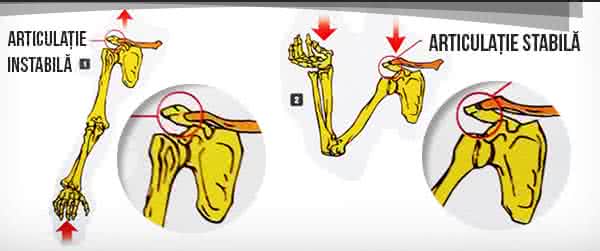 artroza gradului articulațiilor umărului articulația încheieturii artritei reumatoide